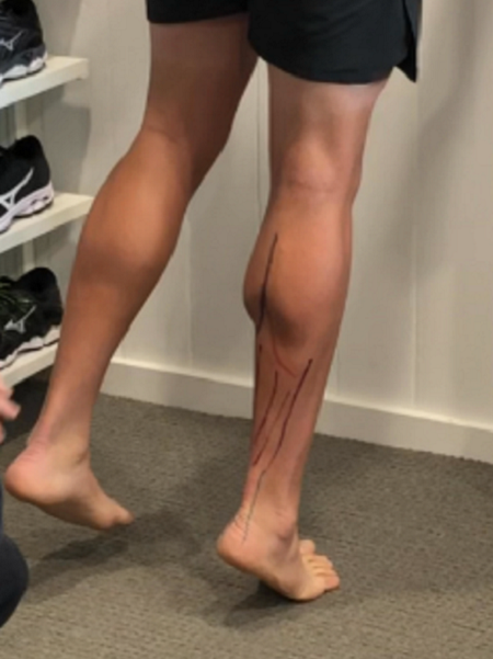 Fix Tight Calves! [Best Stretches For Tight Calf Muscles] 