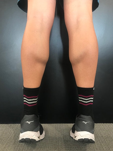 Calf muscle tears: Everything you need to know